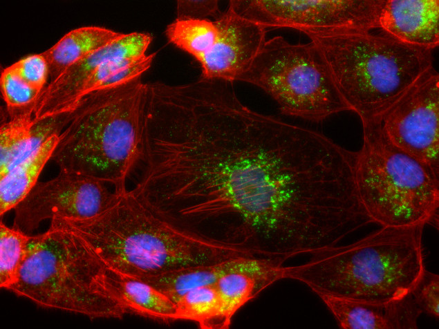 Rabbit IgG (H+L) Cross-Adsorbed Secondary Antibody in Immunocytochemistry (ICC/IF)