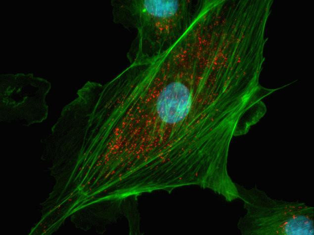 Rabbit IgG (H+L) Cross-Adsorbed Secondary Antibody in Immunocytochemistry (ICC/IF)