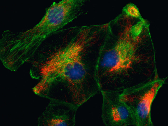 Rabbit IgG (H+L) Cross-Adsorbed Secondary Antibody in Immunocytochemistry (ICC/IF)