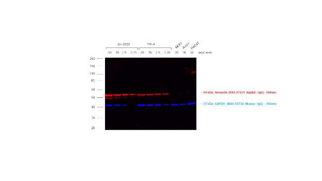 Rabbit IgG (H+L) Cross-Adsorbed Secondary Antibody in Western Blot (WB)