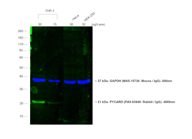 Rabbit IgG (H+L) Secondary Antibody in Western Blot (WB)