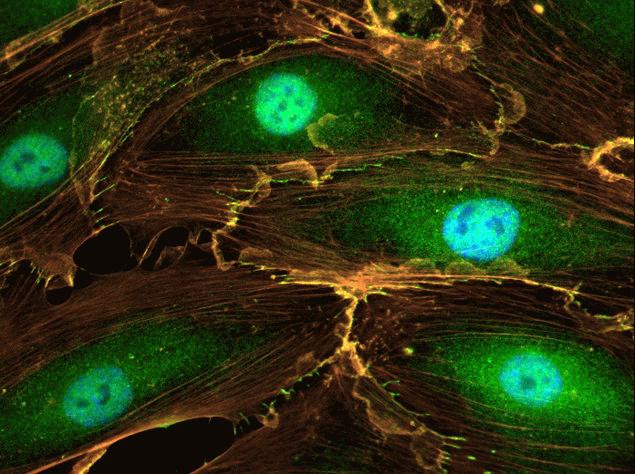 Rabbit IgG (H+L) Secondary Antibody in Immunocytochemistry (ICC/IF)