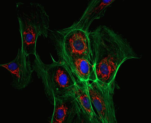 Rabbit IgG (H+L) Secondary Antibody in Immunocytochemistry (ICC/IF)