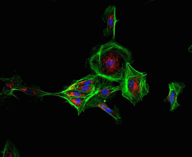 Rabbit IgG (H+L) Secondary Antibody in Immunocytochemistry (ICC/IF)