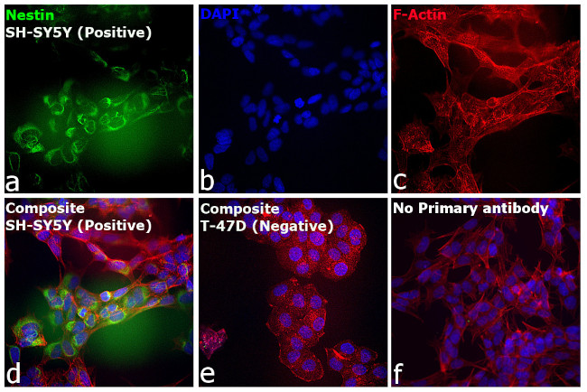 Mouse IgG (H+L) Cross-Adsorbed Secondary Antibody in Immunocytochemistry (ICC/IF)