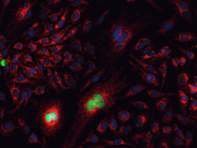 Mouse IgG (H+L) Cross-Adsorbed Secondary Antibody in Immunocytochemistry (ICC/IF)