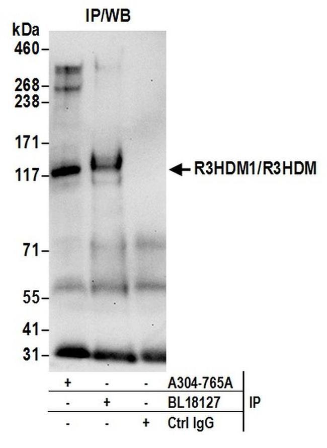 R3HDM1/R3HDM Antibody in Western Blot (WB)