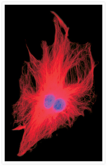 Mouse IgG (H+L) Cross-Adsorbed Secondary Antibody in Immunocytochemistry (ICC/IF)