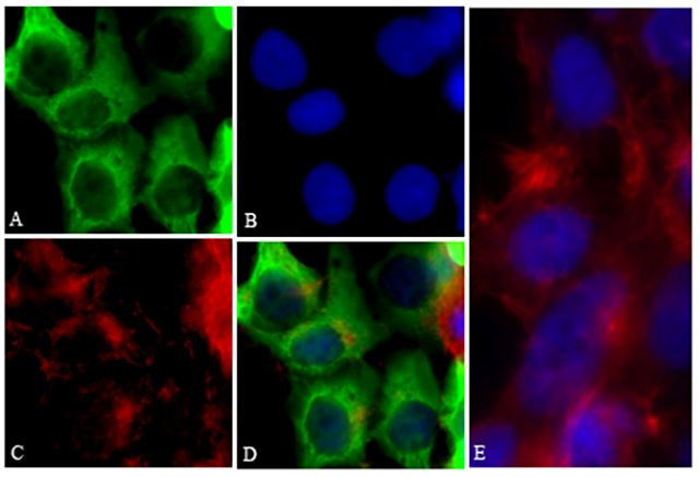 6x-His Tag Antibody in Immunocytochemistry (ICC/IF)