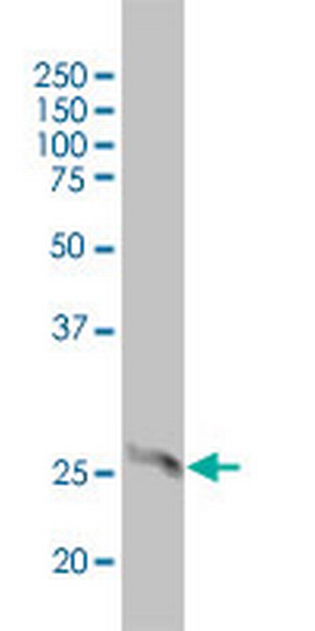 4-1BB Antibody in Western Blot (WB)