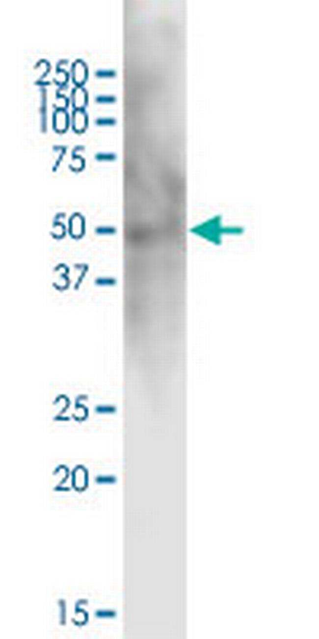 CD28 Antibody in Western Blot (WB)