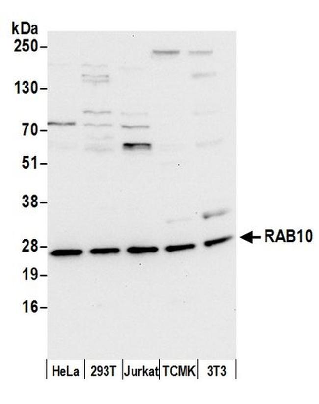 RAB10 Antibody in Western Blot (WB)