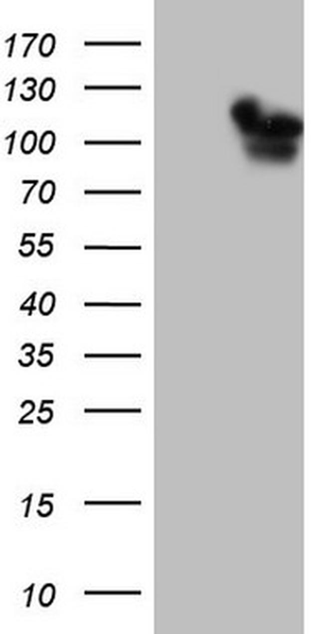 RAB11FIP4 Antibody in Western Blot (WB)