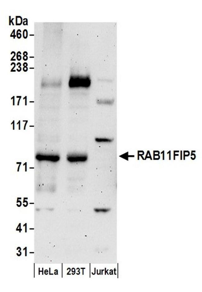 RAB11FIP5 Antibody in Western Blot (WB)