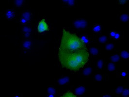 RAB17 Antibody in Immunocytochemistry (ICC/IF)