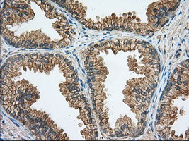 RAB17 Antibody in Immunohistochemistry (Paraffin) (IHC (P))