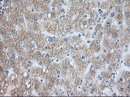 RAB17 Antibody in Immunohistochemistry (Paraffin) (IHC (P))