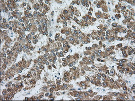 RAB17 Antibody in Immunohistochemistry (Paraffin) (IHC (P))