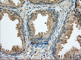 RAB17 Antibody in Immunohistochemistry (Paraffin) (IHC (P))