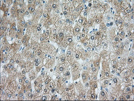 RAB17 Antibody in Immunohistochemistry (Paraffin) (IHC (P))