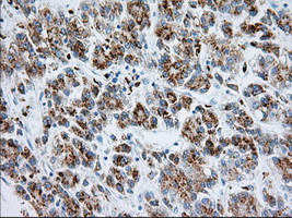 RAB17 Antibody in Immunohistochemistry (Paraffin) (IHC (P))