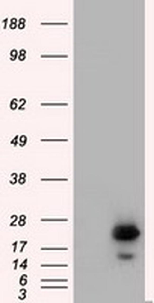 RAB17 Antibody in Western Blot (WB)