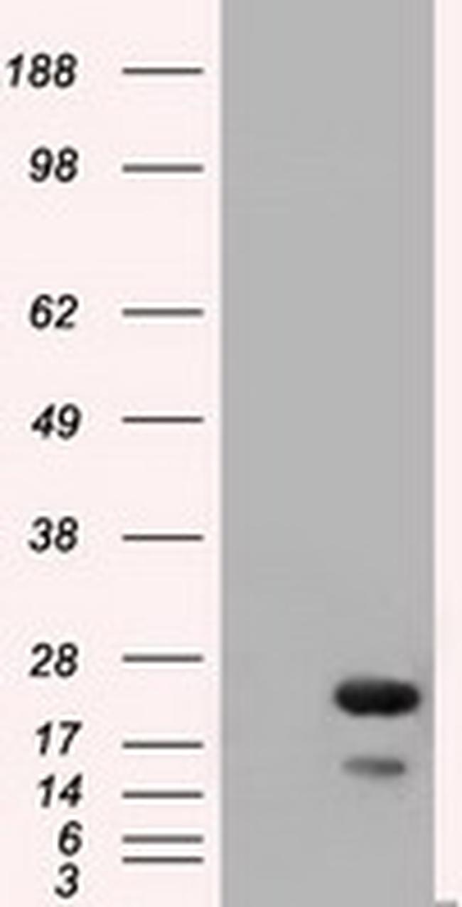 RAB17 Antibody in Western Blot (WB)