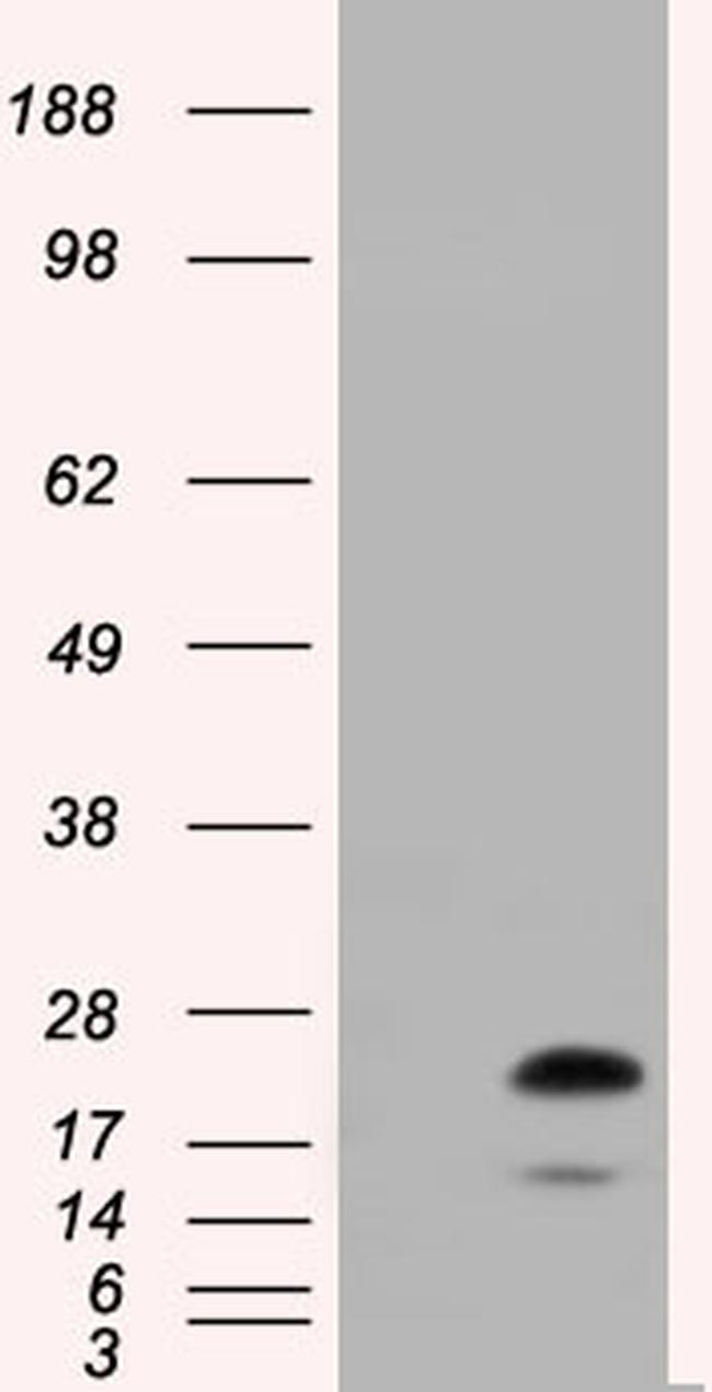 RAB17 Antibody in Western Blot (WB)