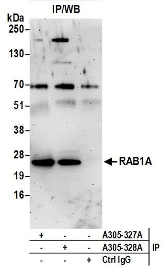 RAB1A Antibody in Immunoprecipitation (IP)