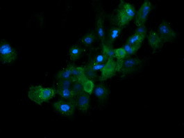 RAB21 Antibody in Immunocytochemistry (ICC/IF)