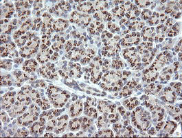 RAB21 Antibody in Immunohistochemistry (Paraffin) (IHC (P))