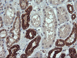 RAB21 Antibody in Immunohistochemistry (Paraffin) (IHC (P))