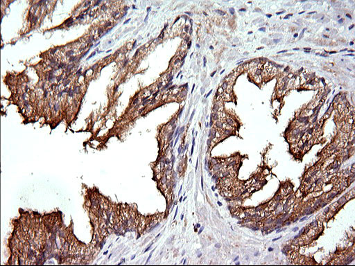 RAB21 Antibody in Immunohistochemistry (Paraffin) (IHC (P))