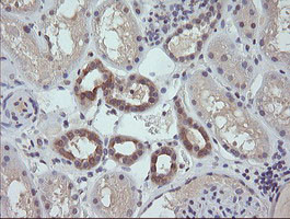 RAB21 Antibody in Immunohistochemistry (Paraffin) (IHC (P))