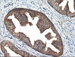 RAB21 Antibody in Immunohistochemistry (Paraffin) (IHC (P))