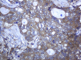 RAB21 Antibody in Immunohistochemistry (Paraffin) (IHC (P))