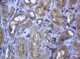 RAB21 Antibody in Immunohistochemistry (Paraffin) (IHC (P))