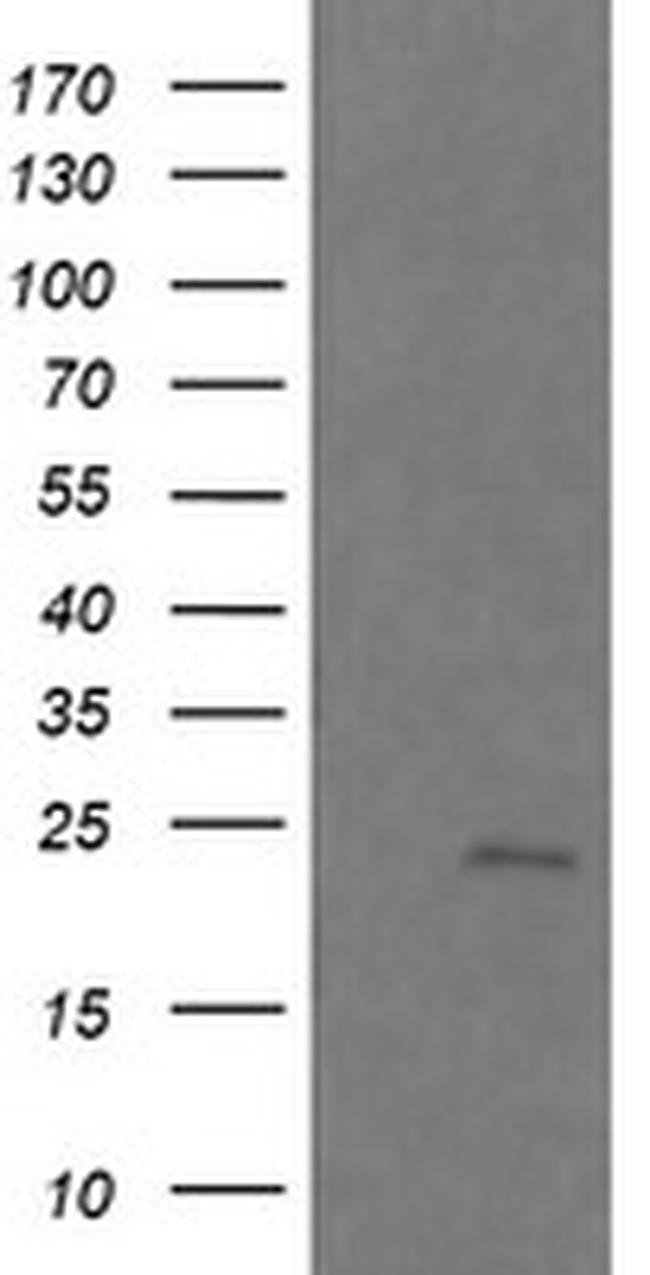 RAB21 Antibody in Western Blot (WB)