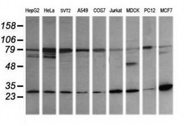 RAB21 Antibody in Western Blot (WB)