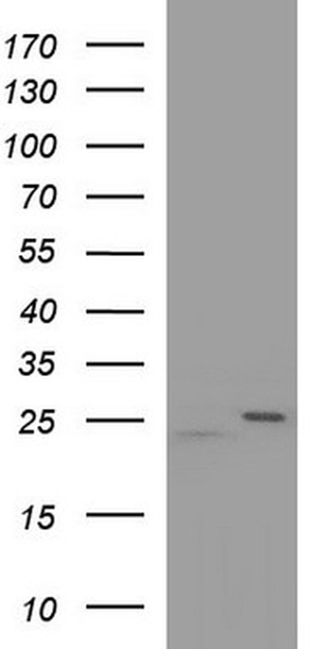 RAB21 Antibody in Western Blot (WB)