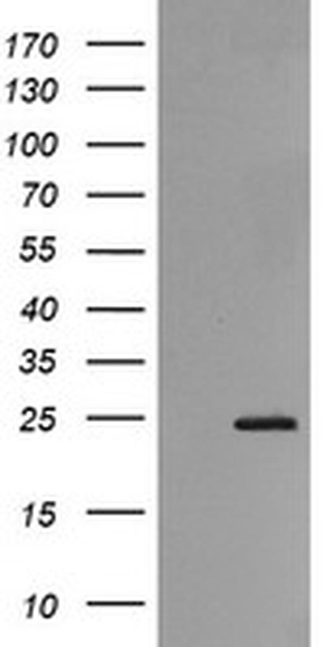 RAB21 Antibody in Western Blot (WB)