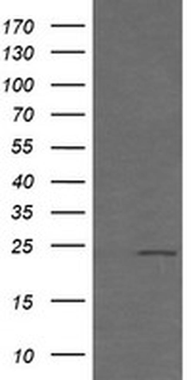 RAB21 Antibody in Western Blot (WB)