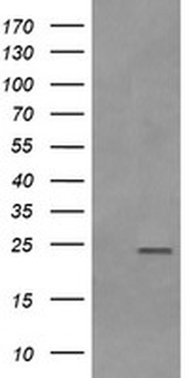 RAB21 Antibody in Western Blot (WB)