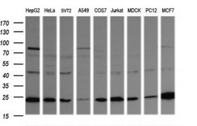 RAB21 Antibody in Western Blot (WB)