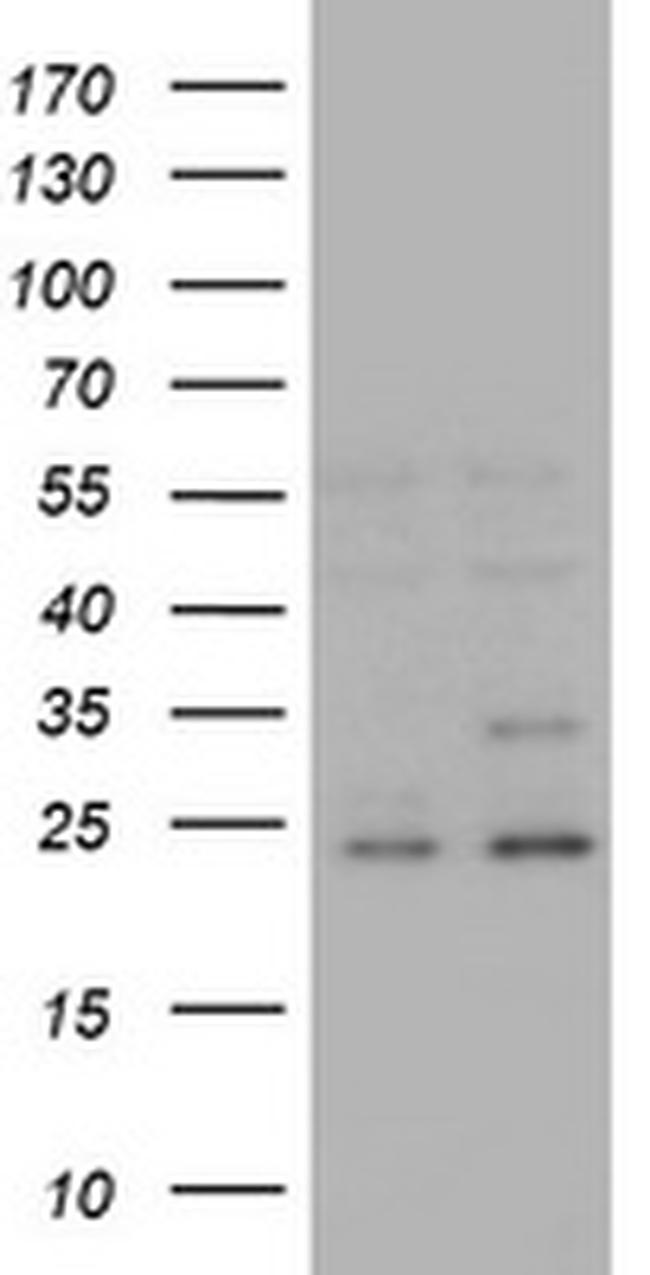 RAB21 Antibody in Western Blot (WB)