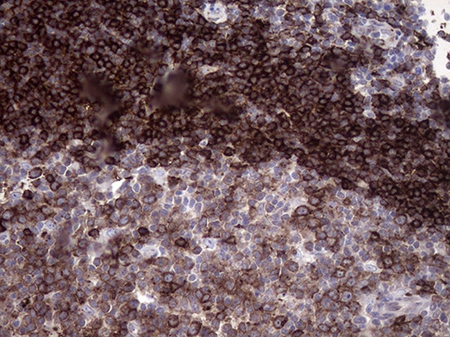 RAB23 Antibody in Immunohistochemistry (Paraffin) (IHC (P))