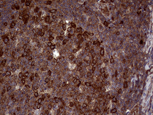 RAB23 Antibody in Immunohistochemistry (Paraffin) (IHC (P))