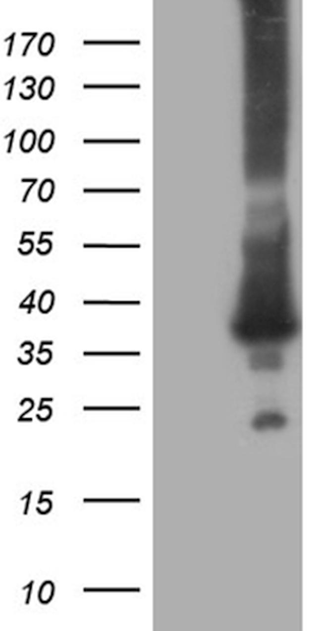 RAB23 Antibody in Western Blot (WB)