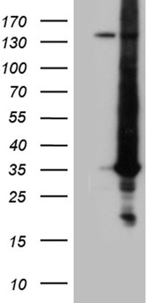 RAB23 Antibody in Western Blot (WB)