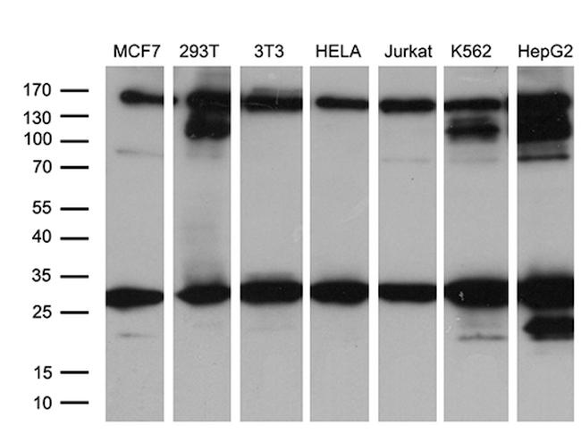 RAB23 Antibody in Western Blot (WB)